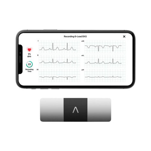 Portable 6 Lead ECG Device FDA Cleared for Home Use