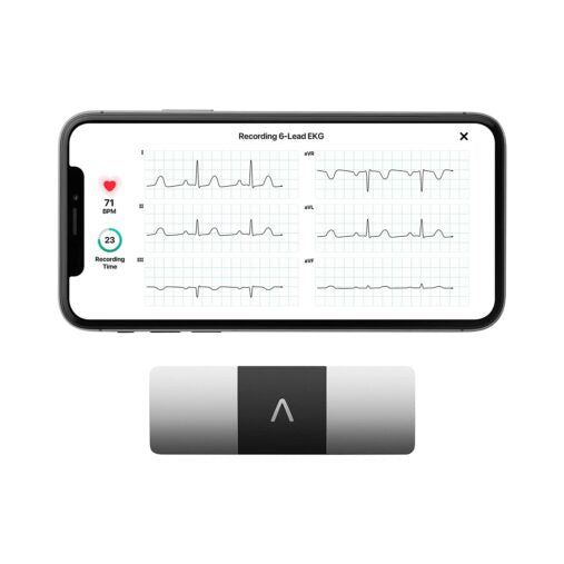Portable 6 Lead ECG Device FDA Cleared Home Heart Monitor