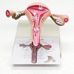 Uterus Ovary Model Body Anatomy Replica of Female Reproductive System Organ Anatomical Model with base  showing the common Pathologies for Doctors Office Educational Tool spancare