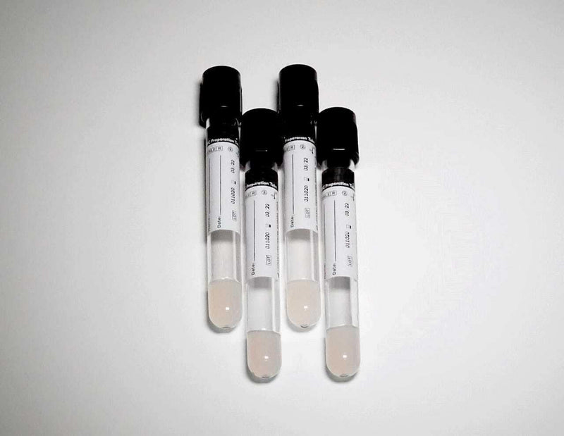 Spancare Autologus Conditioned GFC Preparation Tube for Hair Draw Volume 6 mL 2 Box spancare