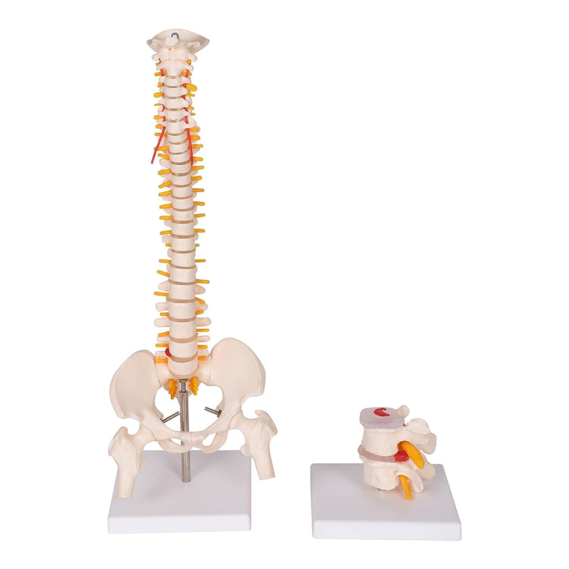 Mini Spine Model with VERTEBRAE Degeneration Model (Educational Model) spancare