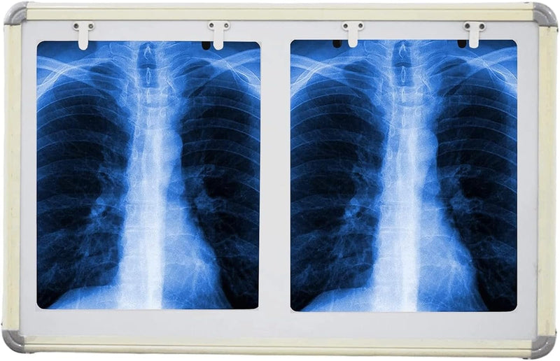 LED X-Ray View Box, Double Film, 28 x 17 Inch, Automatic Film Activation, Variable Brightness Control spancare