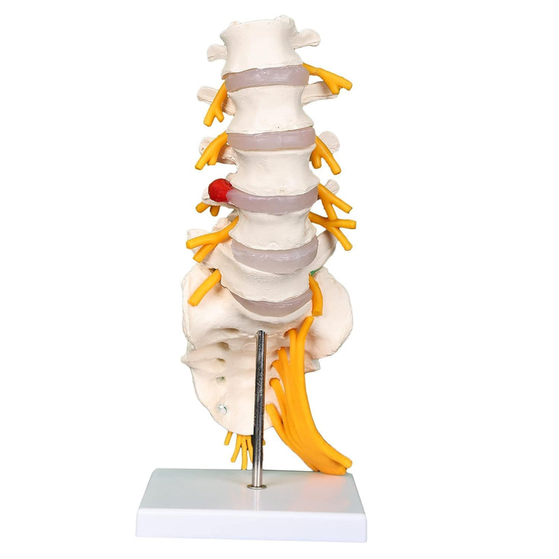 Lumbar Sacrum Spine Model (ORTHOPADIC Model) spancare