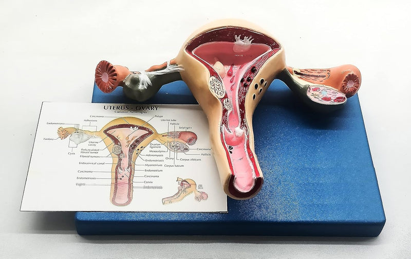 SPANCARE PHARMACEUTICALS Uterus and Ovary Model Female Reproductive Organ Model Human Anatomy Replica Showing Teaching Anatomical Gynecology Doctor Patient Communication Simulation spancare